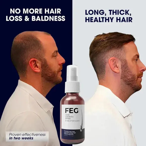 FEG PLUS Hair Growth Spray