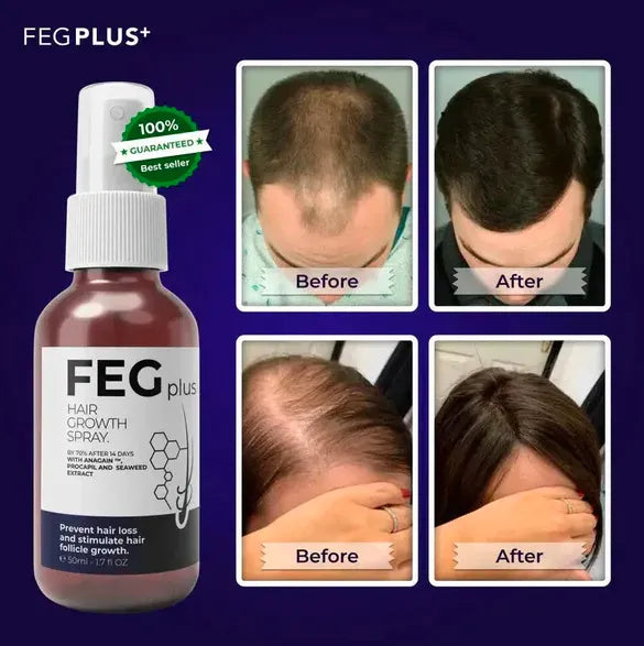 FEG PLUS Hair Growth Spray